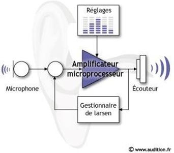 Figure 73&nbsp;: Fonctionnement d’une prothèse auditive conventionnelle.